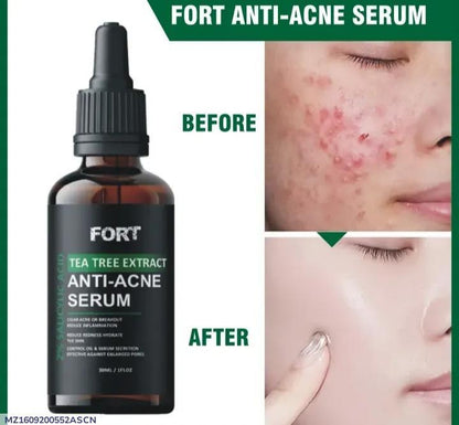 Fort Anti-Acne Face Serum
