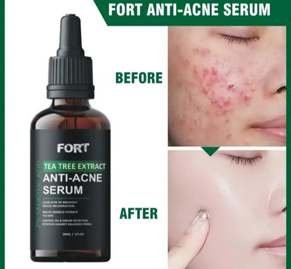 Fort Anti-Acne Face Serum